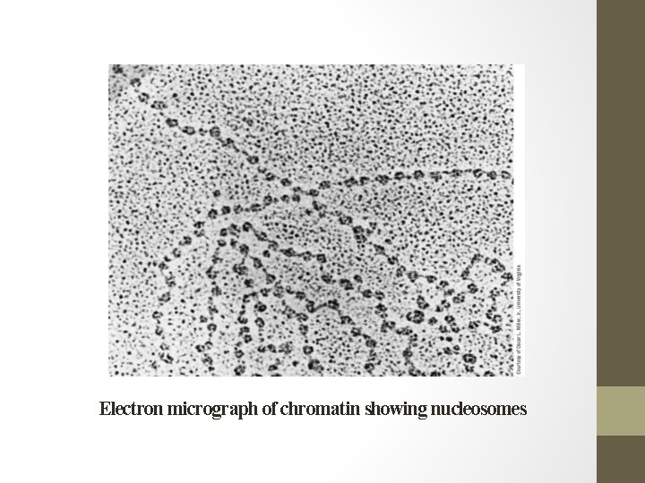 Electron micrograph of chromatin showing nucleosomes 