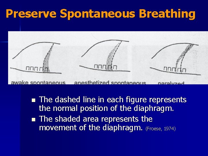 Preserve Spontaneous Breathing n n The dashed line in each figure represents the normal