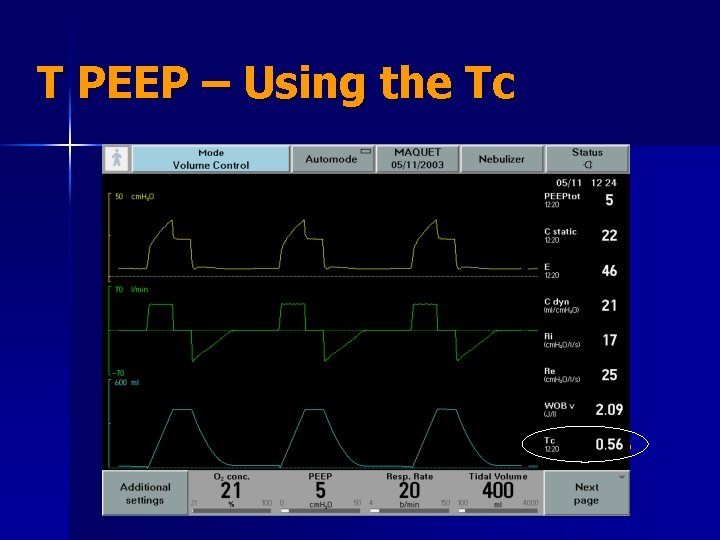 T PEEP – Using the Tc 