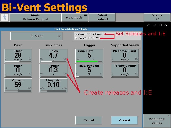 Bi-Vent Settings Set Releases and I: E Create releases and I: E 