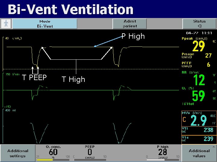 Bi-Ventilation P High T PEEP T High 