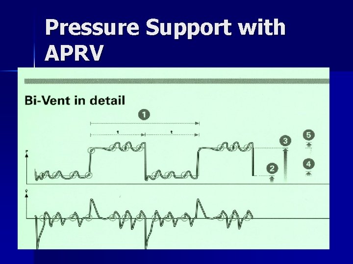 Pressure Support with APRV 