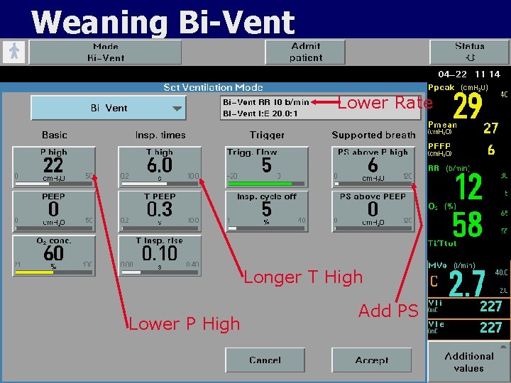 Weaning Bi-Vent Lower Rate Longer T High Lower P High Add PS 
