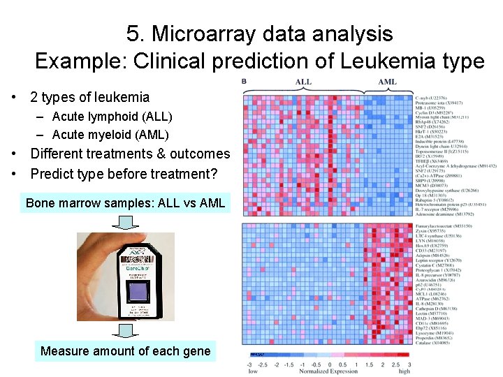 5. Microarray data analysis Example: Clinical prediction of Leukemia type • 2 types of