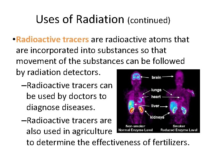 Uses of Radiation (continued) • Radioactive tracers are radioactive atoms that are incorporated into