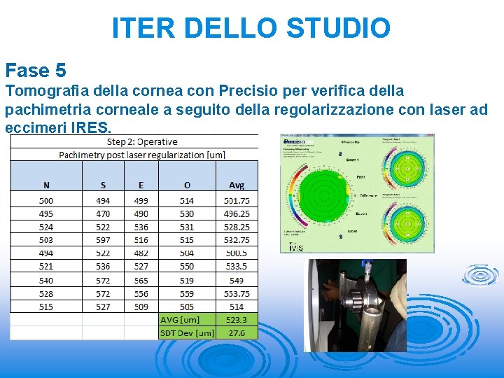 ITER DELLO STUDIO Fase 5 Tomografia della cornea con Precisio per verifica della pachimetria
