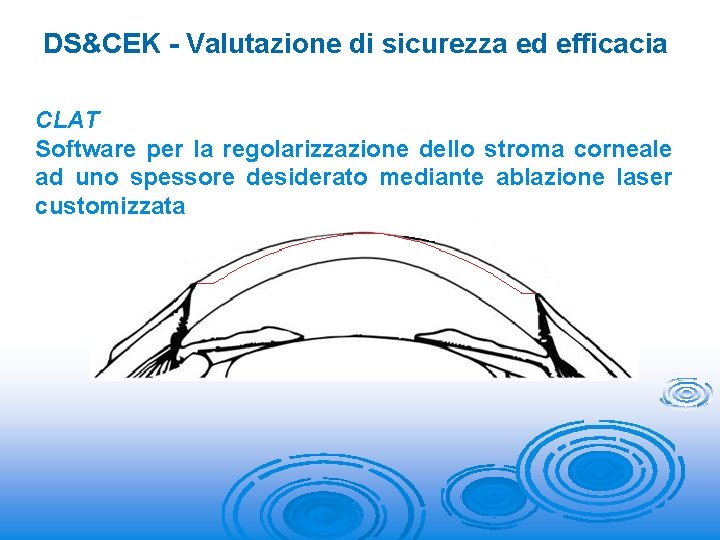 DS&CEK - Valutazione di sicurezza ed efficacia CLAT Software per la regolarizzazione dello stroma