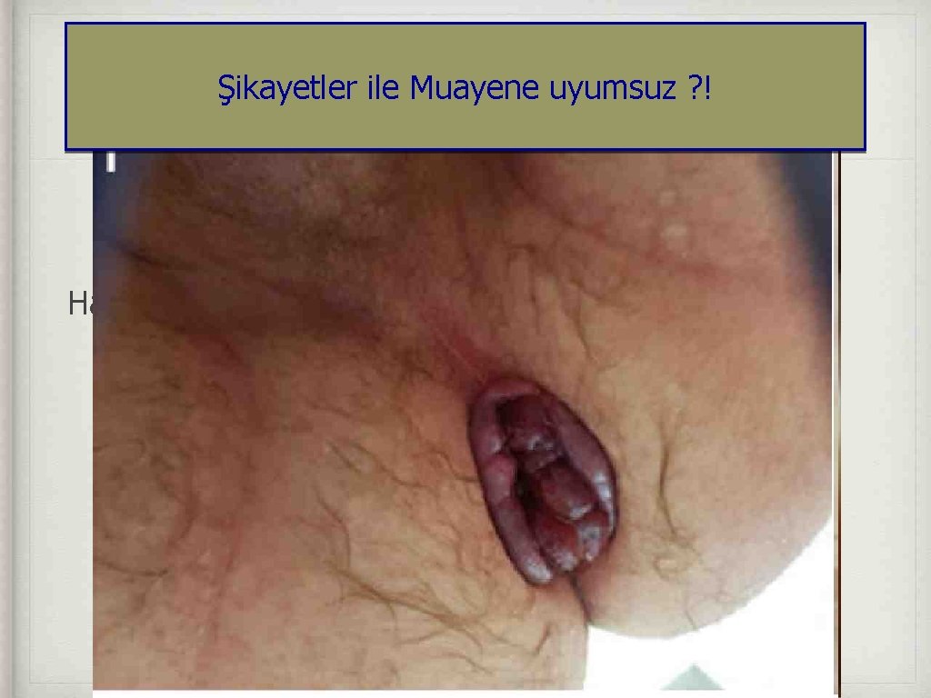 Şikayetler ile Muayene uyumsuz ? ! Hastanın evde foto çekmesi istenebilir 