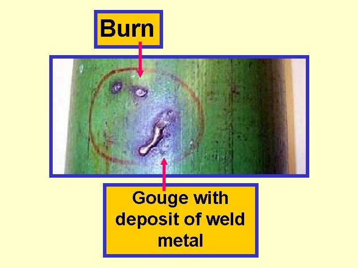 Burn Gouge with deposit of weld metal 