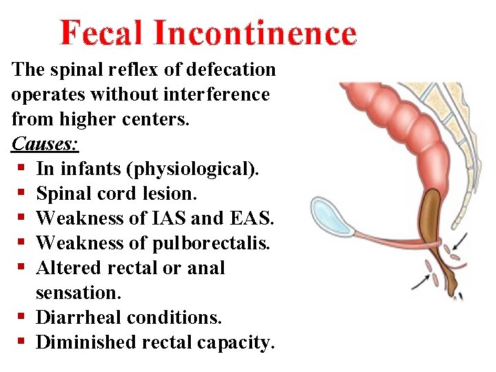 Fecal Incontinence The spinal reflex of defecation operates without interference from higher centers. Causes: