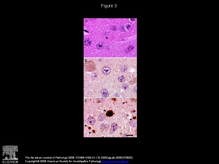 Figure 3 The American Journal of Pathology 2008 172406 -416 DOI: (10. 2353/ajpath. 2008.