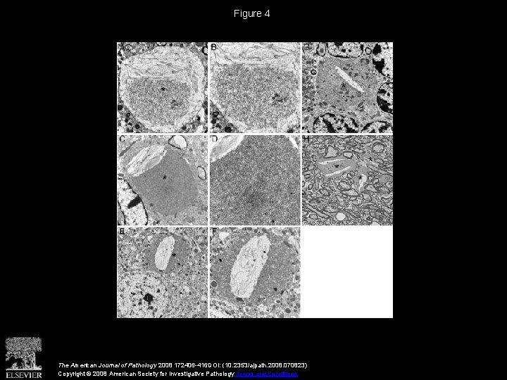 Figure 4 The American Journal of Pathology 2008 172406 -416 DOI: (10. 2353/ajpath. 2008.