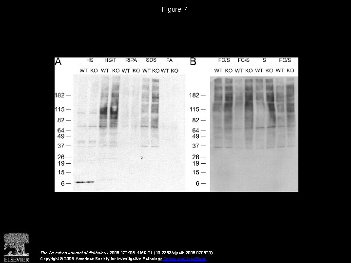 Figure 7 The American Journal of Pathology 2008 172406 -416 DOI: (10. 2353/ajpath. 2008.