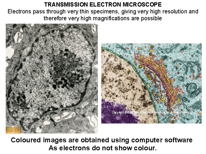 TRANSMISSION ELECTRON MICROSCOPE Electrons pass through very thin specimens, giving very high resolution and