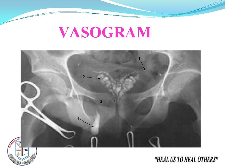 VASOGRAM 