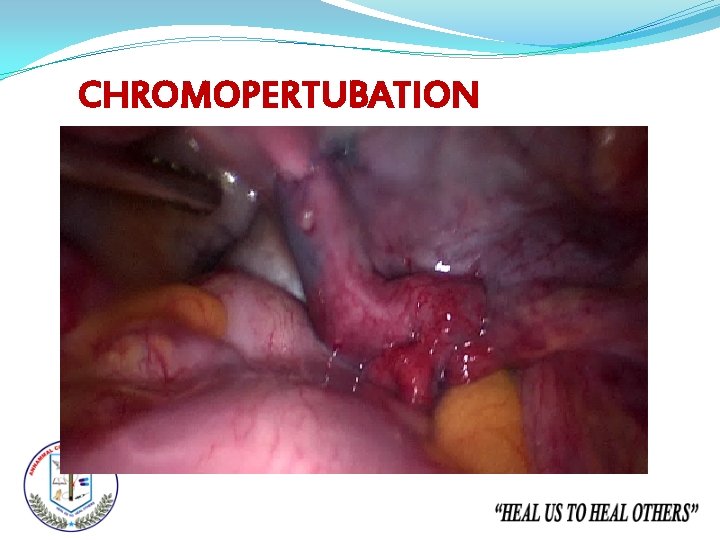 CHROMOPERTUBATION 