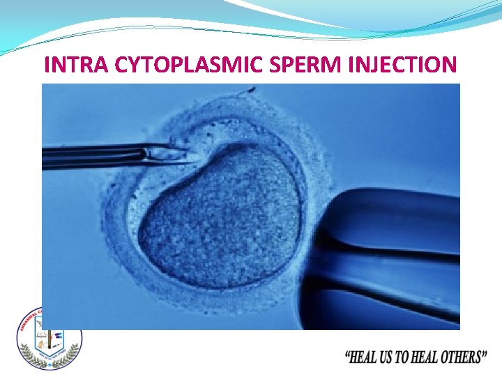 INTRA CYTOPLASMIC SPERM INJECTION 