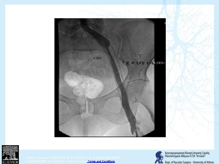 Fig 6 Journal of Vascular Surgery 2009 49, 511 -518 DOI: (10. 1016/j. jvs.