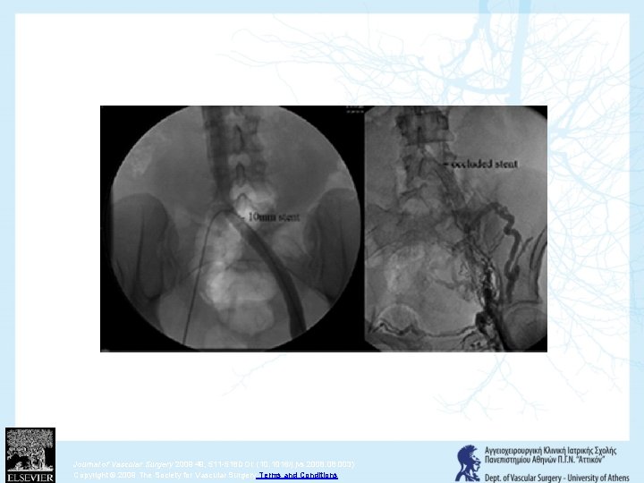 Fig 9 Journal of Vascular Surgery 2009 49, 511 -518 DOI: (10. 1016/j. jvs.