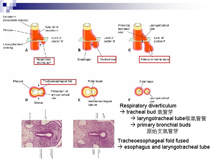 Respiratory diverticulum tracheal bud 氣管芽 laryngotracheal tube喉氣管管 primary bronchial buds 原始支氣管芽 Tracheoesophageal fold fused