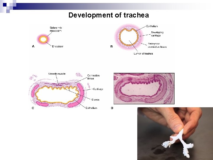 Development of trachea 