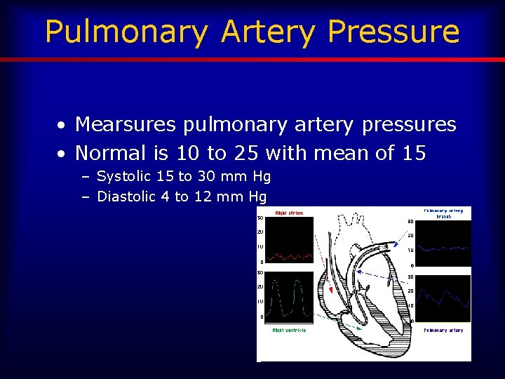 Pulmonary Artery Pressure • Mearsures pulmonary artery pressures • Normal is 10 to 25