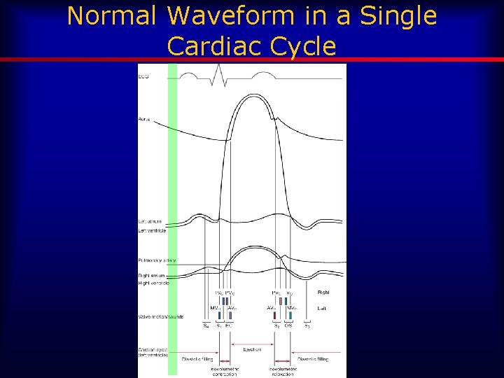 Normal Waveform in a Single Cardiac Cycle 