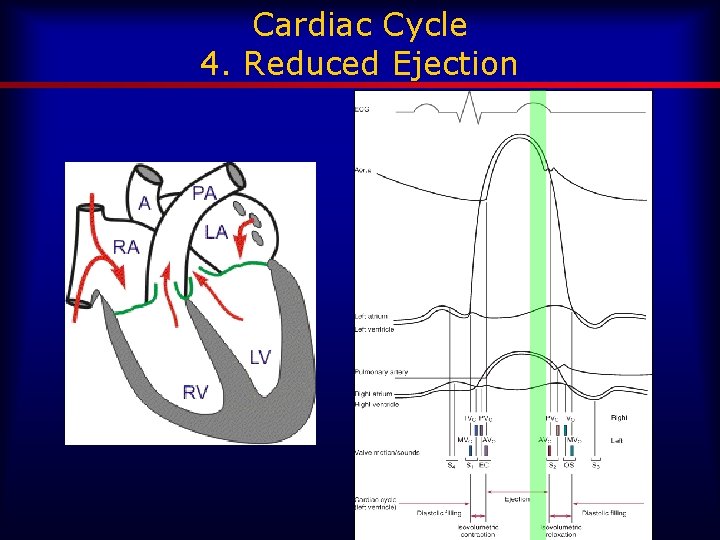 Cardiac Cycle 4. Reduced Ejection 