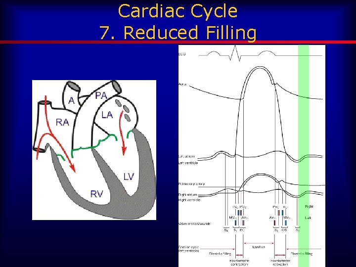 Cardiac Cycle 7. Reduced Filling 