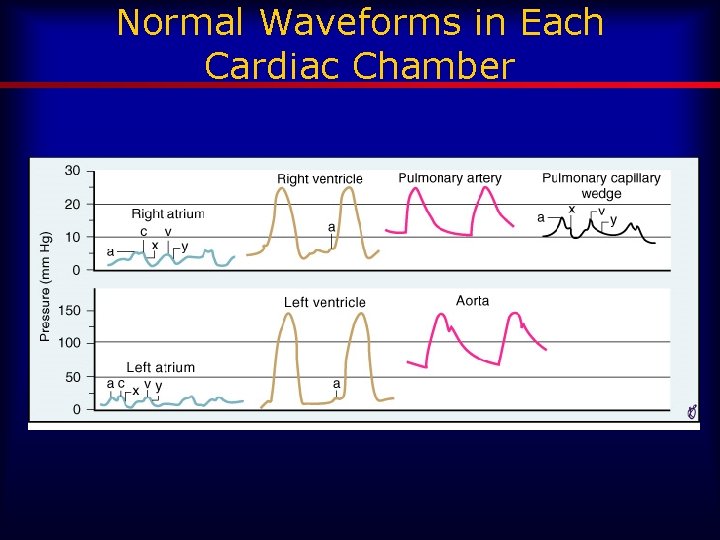 Normal Waveforms in Each Cardiac Chamber 