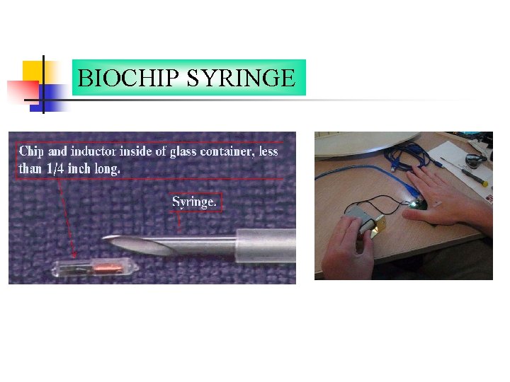 BIOCHIP SYRINGE 