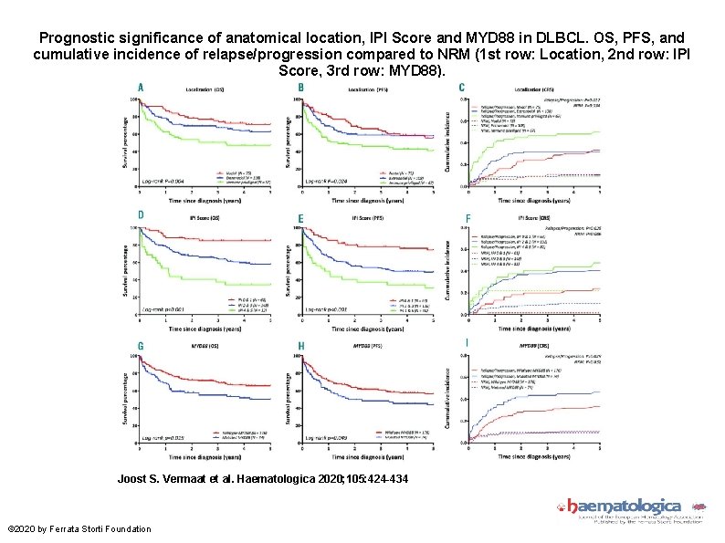 Prognostic significance of anatomical location, IPI Score and MYD 88 in DLBCL. OS, PFS,