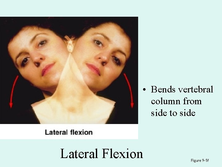 • Bends vertebral column from side to side Lateral Flexion Figure 9– 5