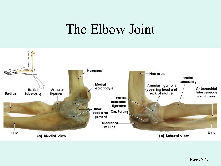 The Elbow Joint Figure 9– 10 
