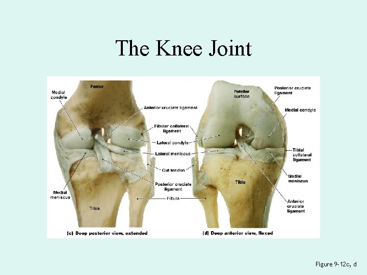 The Knee Joint Figure 9– 12 c, d 