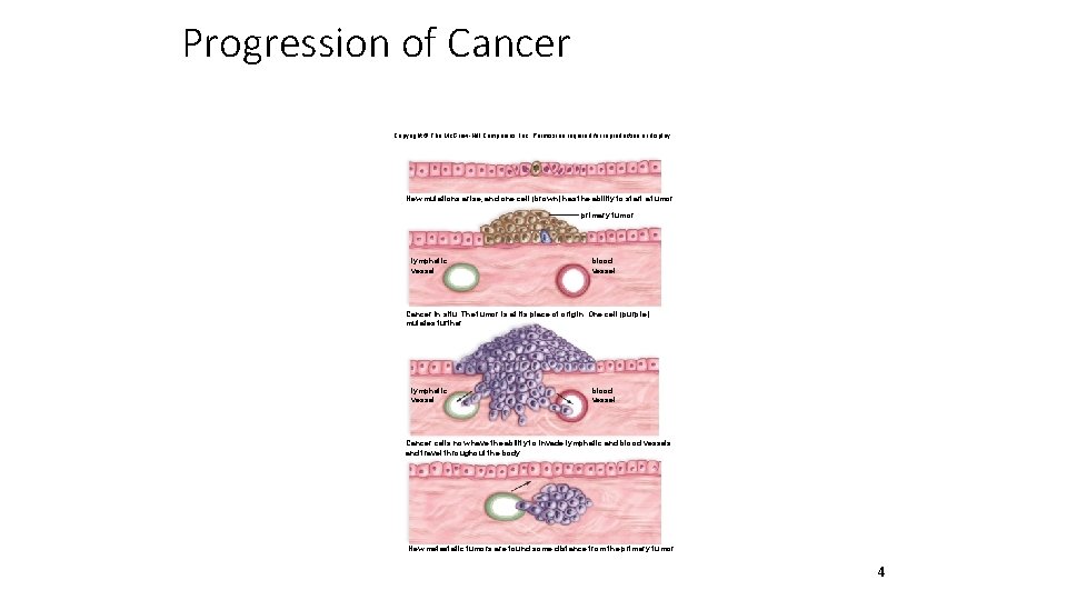 Progression of Cancer Copyright © The Mc. Graw-Hill Companies, Inc. Permission required for reproduction