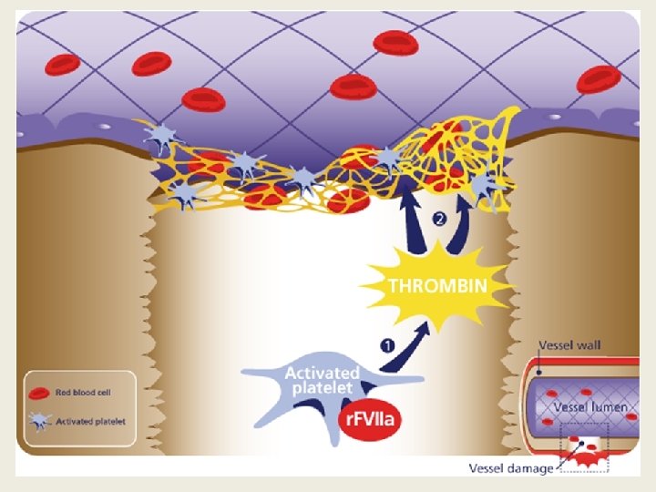Recombinant Factor Vlla • Enhancing the normal FVIIa –Tissue factor(TF) dependent pathway of hemostasis