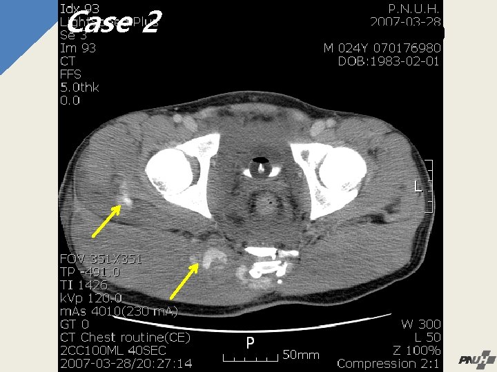 Case 2 2 