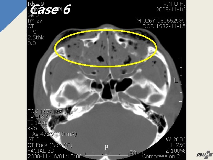 Case 6 6 