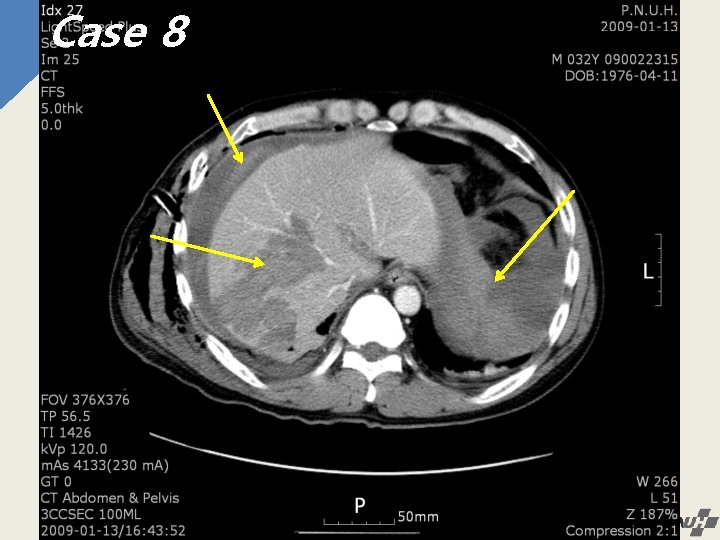 Case 8 