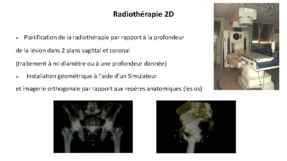 Nouvelles Techniques En Radiothrapie Dr Sonia RouxPalobart Service