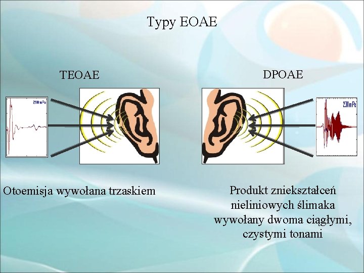 Typy EOAE TEOAE DPOAE Otoemisja wywołana trzaskiem Produkt zniekształceń nieliniowych ślimaka wywołany dwoma ciągłymi,