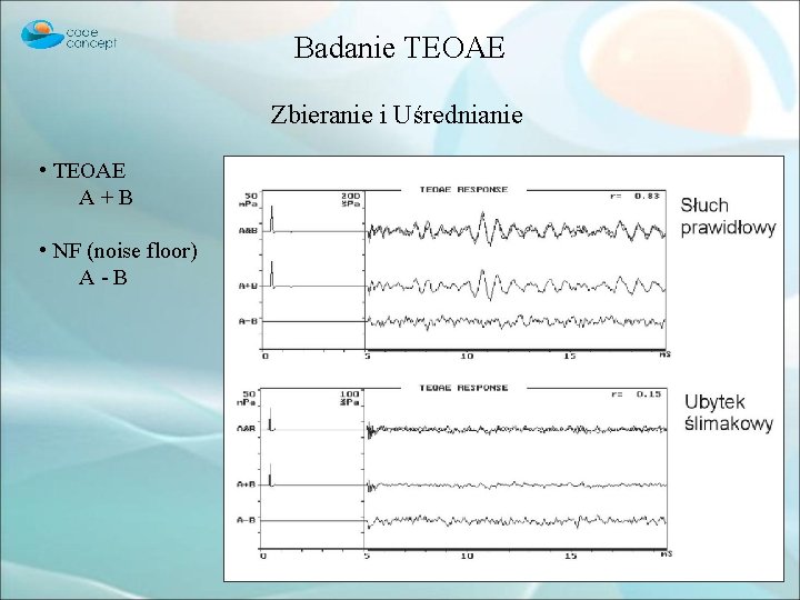 Badanie TEOAE Zbieranie i Uśrednianie • TEOAE A+B • NF (noise floor) A-B 