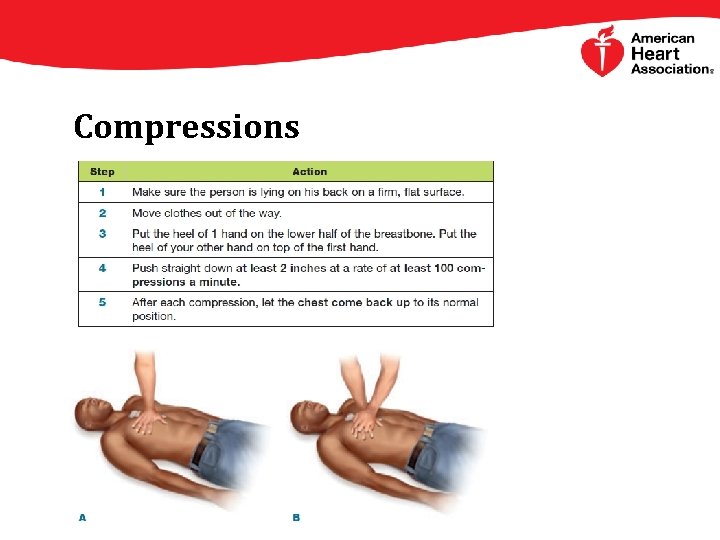 Compressions 