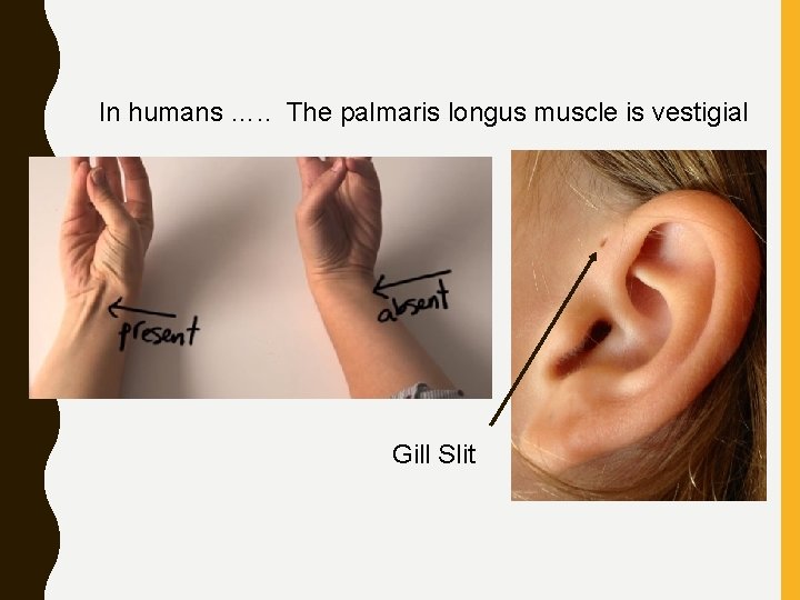 In humans …. . The palmaris longus muscle is vestigial Gill Slit 