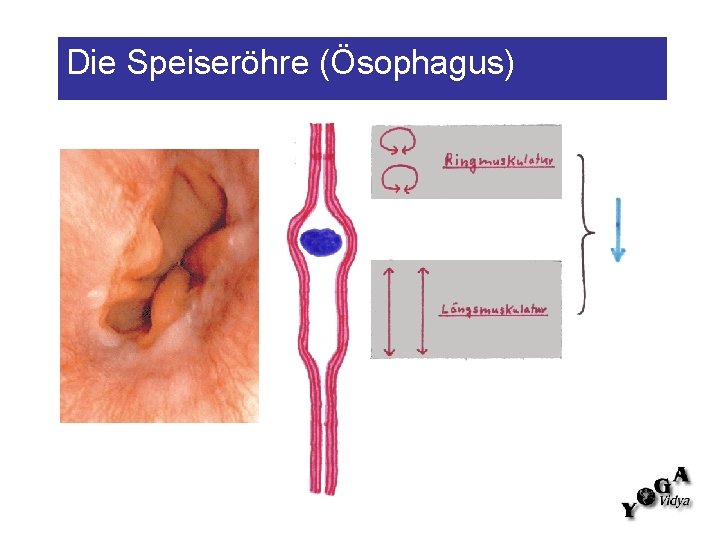 Die Speiseröhre (Ösophagus) 
