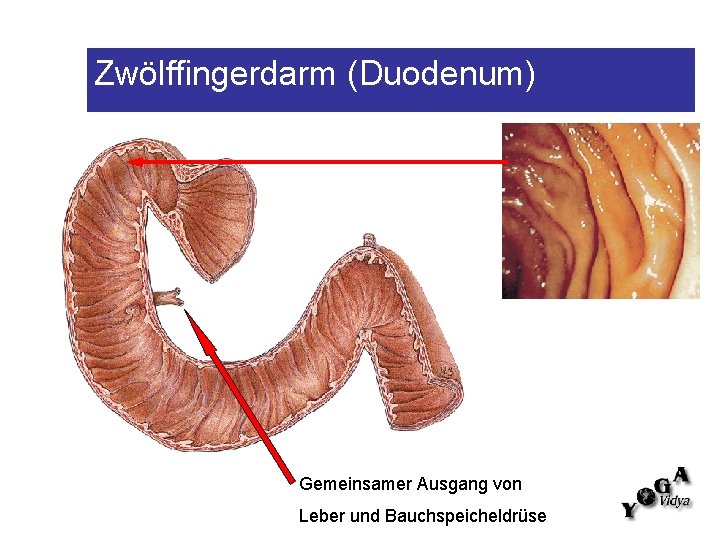 Zwölffingerdarm (Duodenum) Gemeinsamer Ausgang von Leber und Bauchspeicheldrüse 