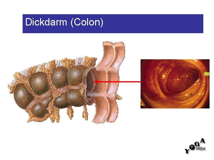 Dickdarm (Colon) 