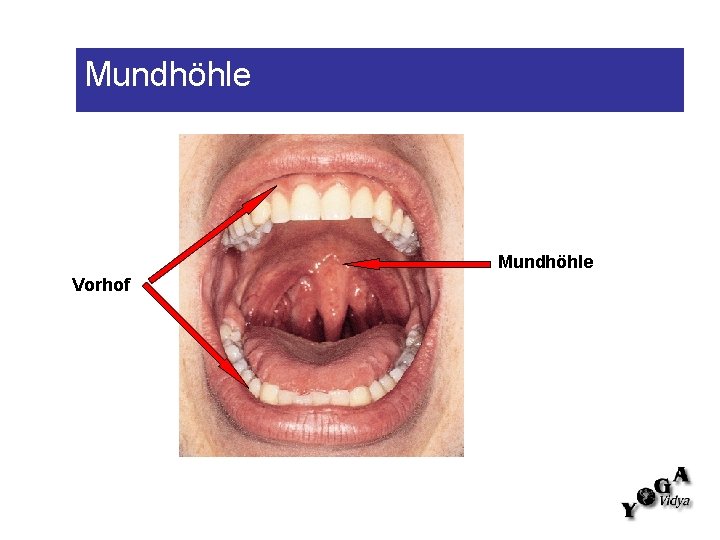 Mundhöhle Vorhof 