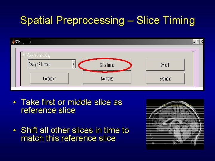 Spatial Preprocessing – Slice Timing • Take first or middle slice as reference slice